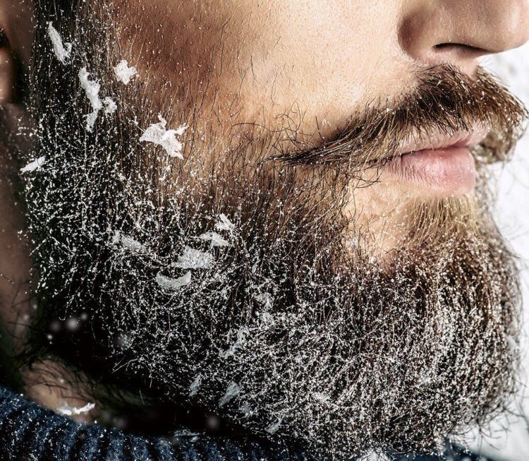 How To Stop That Pesky Beard Dandruff